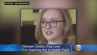 'Let's Get Started': Woman Credits True Love For Conquering Rare Syndrome