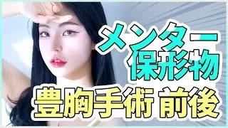 メンター保形物豊胸手術前後 #整形レビュー #モティバ豊胸術