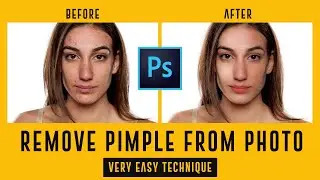Remove pimples from Photos using Photoshop- Photo Retouching