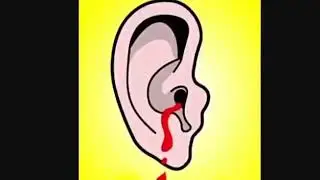 Make the ground shake EARAPE