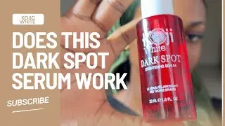 Koji White Dark Spot Serum Review |How to Fade Dark Spots, Hyperpigmentation & Dark Neck |