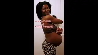 Watch this post baby body transformation 😭 #postpartum #newmom #shorts