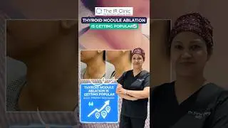 Thyroid Swelling? See How Thyroid Nodule Ablation Works | Quick Recovery, No Scar, No Surgery