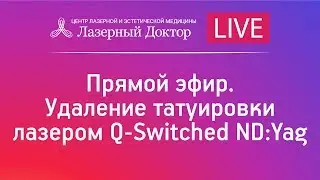 Прямой эфир. Удаление татуировки лазером Q-Switched ND:Yag