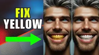 Quick Remedies for Yellow Teeth: Quick Fix for Yellow Teeth