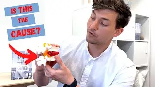 REVEALED: How a Disc Bulge Causes Sciatica