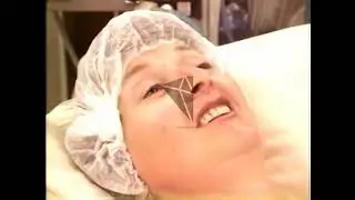 anesthesia taking effect