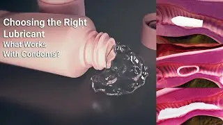 Choosing the right lubricant