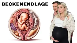 Beckenendlage - Äußere Drehung oder Kaiserschnitt? | FitnessCouple Reaktion