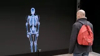 Bone VS steel