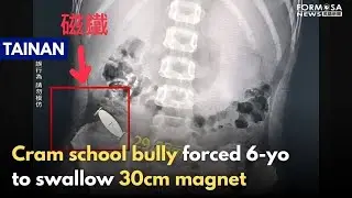 Cram school owner’s kid forces 6-yo to swallow 3cm magnet｜Taiwan News