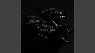 SCARS