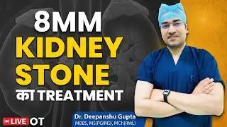 8MM Kidney Stone LIVE Surgery | Laser से निकली 8MM Stone | RIRS Laser Kidney Treatment #rirs