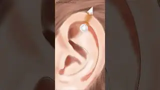 ASMR Treatment Animation Girl ear satisfying treatment