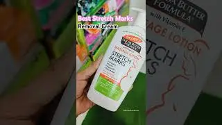 Post pregnancy Stretch Marks Cream 💫 palmers stretch mark cream | Remove Stretch Marks #drmenkavarma