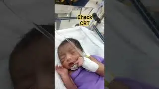 checked capillary refile time 😊 | check CRT 😊 #nicu #babycare #newborn #baby