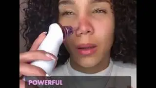 #1 Rated Blackhead Vacuum Remover