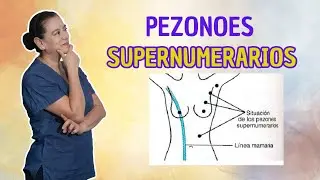 LACTANCIA  & PEZONES SUPERNUMERARIOS