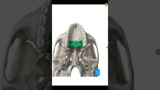 Lec 2 anatomy GIT palate ( Hard palate - soft palate)