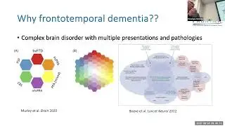 A Short History, Clinical Program and Research Update - Professor Olivier Piguet