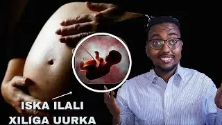 8-Kan Calamaadod Iska Ilali Xiliga Uurka!