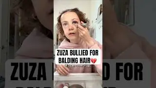 Zuza Bullied For Balding Hair #shorts #glowhouse #zuzabeine