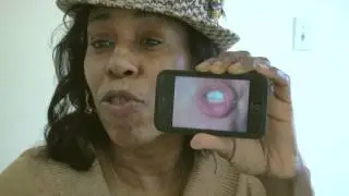 USC stroke trial looking to help speech impairment