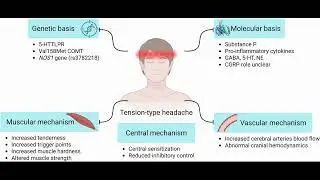 Tension Headache: Signs of Primary Headache: Part 2