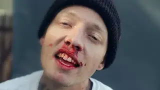 Kyler Slater - Nosebleeds (Official Video)