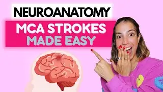 MCA Strokes Made Easy for Neuro Physical Therapists (Without the Overwhelm)