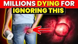 12 Shocking Colon Cancer Warning Signs You MUST Not Ignore!