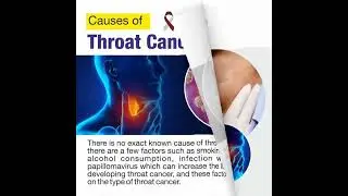 Type of Thyroid Cancer #thyroid #cancer #cancerawareness #thyroidcancer #health #healthylifestyle