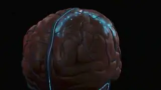 First Brain-Computer Interface Implant Announced