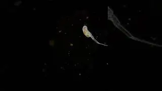 Rotifer under microscope - Scaridium longicaudum #science