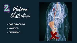 T&iacute;tulo: Abdome Agudo &mdash; Diagn&oacute;stico, Conduta e Racioc&iacute;nio Cl&iacute;nico na Urg&ecirc;ncia