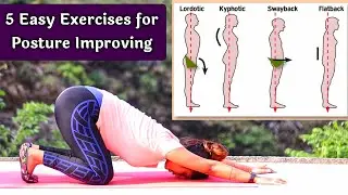 Correct Posture Yoga | How to Fix Bad Posture at Home | Bad Posture Exercises in Hindi