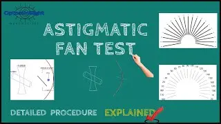 Astigmatic Fan Test: Detailed Procedure and Principle Explained