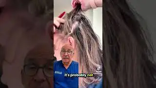 Scalp Psoriasis: How to Treat Hair Loss and Find Relief