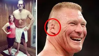 10 Wrestlers Who Suffered With Illnesses & Body Deformities (WWE etc)