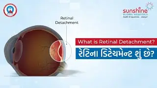 Retinal Detachment | What is Retinal Detachment? Explained by Vitreo Retinal Specialist (Gujarati)