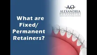 Alexandria Orthodontics: What is a fixed or permanent retainer?