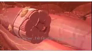 Muscle cramps