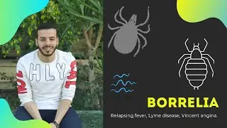 20-Borrelia.