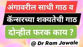 अंगावरील साधी गाठ व कॅन्सरच्या शक्यतेची गाठ,दोन्हीत फरक काय ?||120||@drramjawale