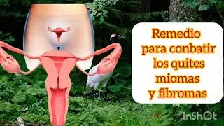 Remedio para conbatir los quites miomas y fibromas