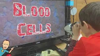 Viewing Blood Cells Under a Microscope | Swift 380T