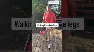 Walking in my prosthetic legs: progress