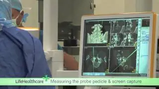 BodyTom Portable CT - How it Works