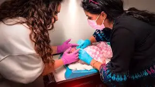 Cutting our baby's tongue-tie | Colic and Acid Reflux Baby | Will it work?