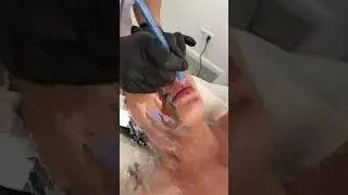 Jet Peel Aqua
